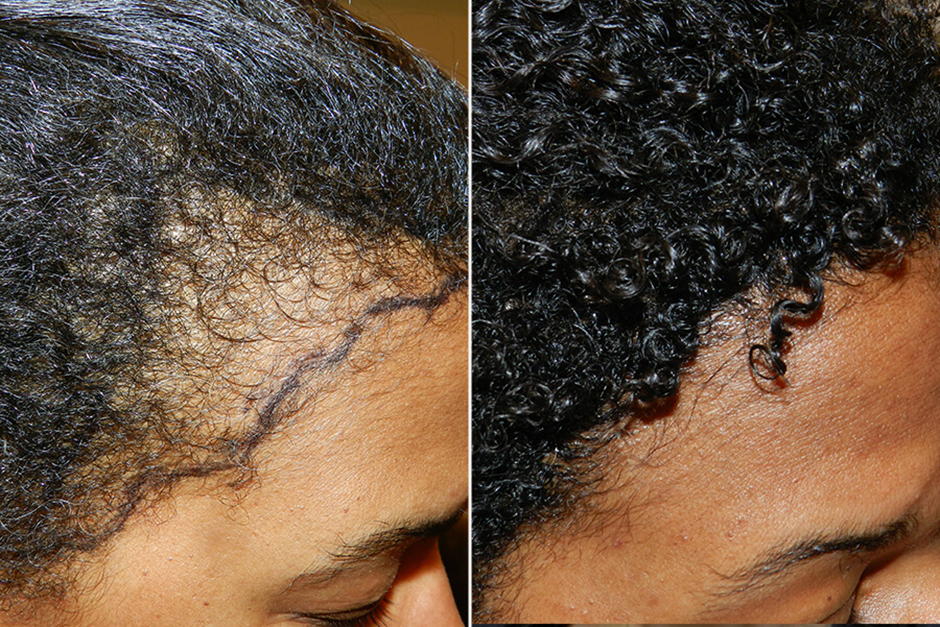 Amina Carters Journey using I am Divine Hair Growth Oil